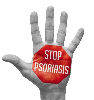 Prävention von Psoriasis