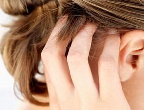 Anzeichen und Symptome einer Psoriasis auf der Kopfhaut